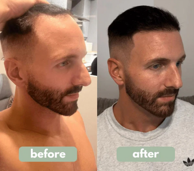 VELISSE Hair Growth Roll-On Serum