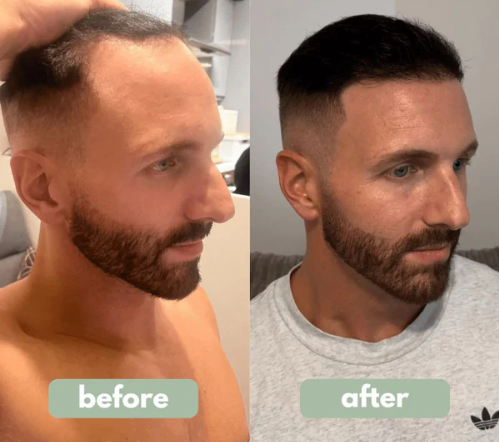 VELISSE Hair Growth Roll-On Serum