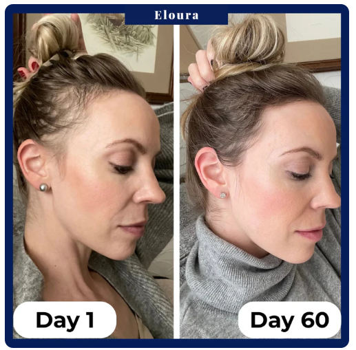 VELISSE Hair Growth Roll-On Serum