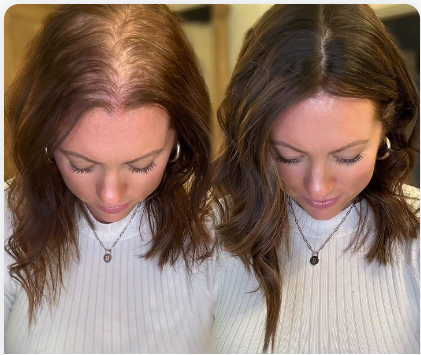 VELISSE Hair Growth Roll-On Serum