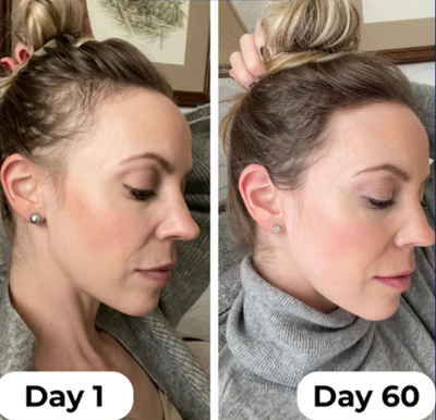 VELISSE Hair Growth Roll-On Serum