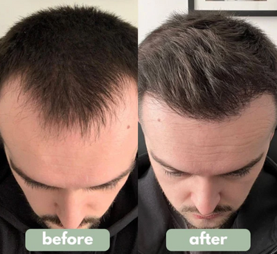 VELISSE Hair Growth Roll-On Serum