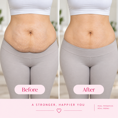 BellyBloom™ Postpartum Massage Ring