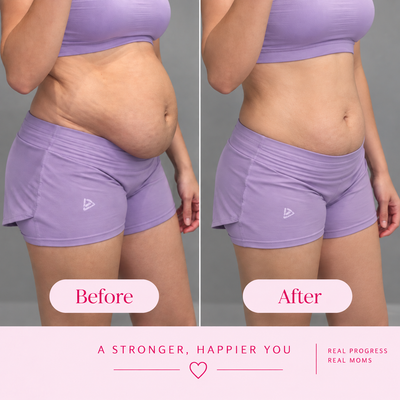 BellyBloom™ Postpartum Massage Ring